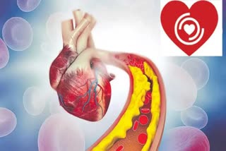 Identifying heart problems with signs and symptoms