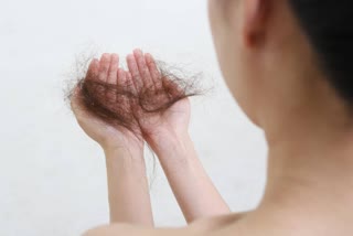 the-problem-of-hair-loss-can-affect-mental-health-know-about-it