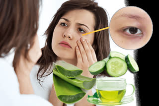 Try these home remedies to get rid of dark circles and eye bags