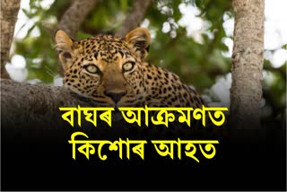 Leopard Attacks a minor boy at Amguri