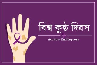 Leprosy is not just a stigma but a disease World Leprosy Day