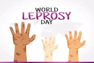 World Leprosy Day 2023  World Leprosy Day  Leprosy Day  Leprosy  Leprosy medicine  what is Leprosy  എന്താണ് കുഷ്‌ഠം  കുഷ്‌ഠം  കുഷ്‌ഠരോഗം  ലോക കുഷ്‌ഠരോഗ നിർമാർജന ദിനം  ലോക കുഷ്‌ഠരോഗ ദിനം  ലോക കുഷ്‌ഠരോഗ നിർമാർജന ദിനം 2023  ലോക കുഷ്‌ഠരോഗ ദിനം 2023  കുഷ്‌ഠരോഗ ദിന സന്ദേശം  World Leprosy Day theme  കുഷ്‌ഠ രോഗം പകരുന്നതെങ്ങനെ  ലെപ്രസി  കുഷ്‌ഠരോഗ നിർമാർജനം  കുഷ്‌ഠരോഗ നിർമാർജന രംഗം