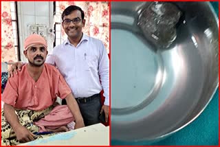 Doctor Removed Stone From Brain In Shirdi