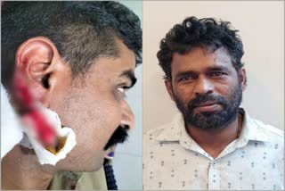 Man Bites Sub-inspector Ear