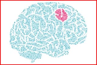 Urine Test For Brain Tumour