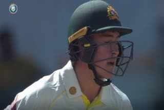 Matthew Renshaw has been sent for a precautionary scan