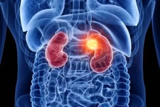 Both Kidney Damage News