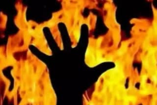 Woman Died Due to Fire : લિવ ઈન પાર્ટનર બન્યો રાક્ષસ, મહિલાને ટર્પેન્ટાઈન ઓઈલ નાખીને સળગાવીનો આરોપ