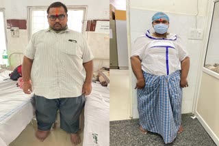 Doctors perform Bariatric Surgery on super obese patient weighing 240 kg