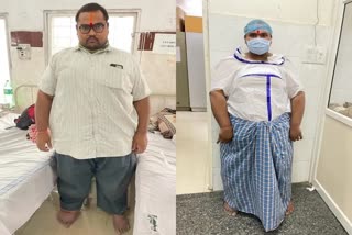 hyderabad-doctors-perform-bariatric-surgery-on-super-obese-patient-weighing-240-kg