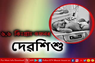 6 kg baby born at Barpeta Medical College Hospital