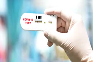 Covid-19 pandemic a result of lab leak US agency