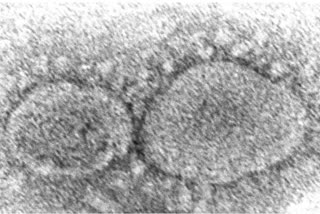 Coronavirus origins still a mystery 3 years into pandemic  കൊവിഡ്  യുഎസ് ഡിപ്പാര്‍ട്ട്മെന്‍റ് ഓഫ് എനര്‍ജി  കൊവിഡ് വൈറസിന്‍റെ  covid virus source  lab leak theory of covid virus  കൊവിഡ് വൈറസിന്‍റെ ഉറവിടം  കൊവിഡ് വൈറസ് എവിടെ നിന്ന് പൊട്ടിപുറപ്പെട്ടു  where did covid virus originate