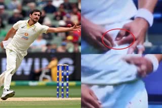 australia fast bowler mitchell starc bowls despite blood dropping off his finger