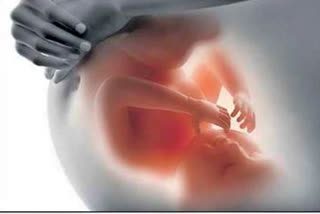 aiims doctors procedure on fetus grape size