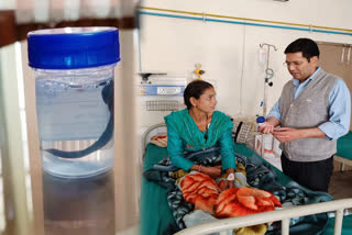 leech enter in trachea of woman in Srinagar