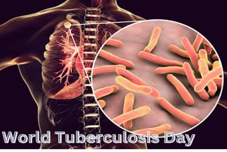 World Tuberculosis Day