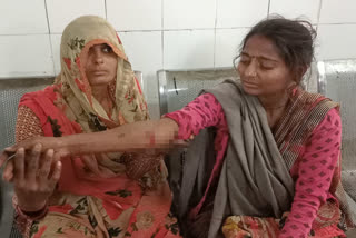 two groups clashed in Dholpur, woman injured in firing