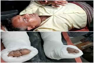 Rajkot Crime: આપના નેતા મુકેશ રાજપરા પર હુમલો, કેબિનેટ પ્રધાન બાવળિયા પર લગાવ્યો આક્ષેપ