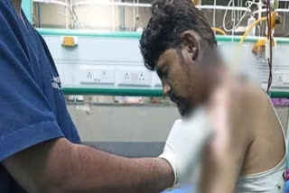 Intoxicated man tries to burn physically challenged man on moving train in Thane