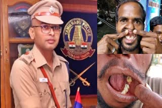 IPS officer pulled out the tooth of Youths  IPS officer pulled out the tooth  pulled out the tooth of Youths in Custody  Tamilnadu Police Chief  Police Chief ordered to transfer  യുവാക്കളുടെ പല്ല് പിഴുതെടുത്ത സംഭവം  പല്ല് പിഴുതെടുത്ത സംഭവം  സിസ്‌റ്റന്റ് സൂപ്രണ്ടിനെതിരെ  പൊലീസ് മേധാവിയുടെ നടപടി  അംബാസമുദ്രം സബ് ഡിവിഷൻ  അംബാസമുദ്രം  പൊലീസ്  ബാല്‍വീര്‍