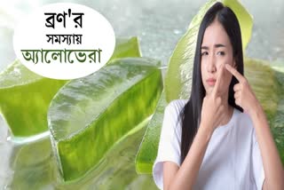 Aloe Vera For Acne News