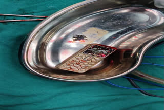 MP: The ingested mobile taken out from patient's stomach after surgery