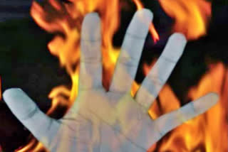 Burning man in middle of traffic shocks Madhya Pradesh's Ujjain