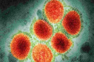 WHO reports first death from H3N8 virus in China