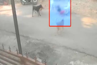 Watch: Pack of dogs attacks 6-year-old in Nagpur