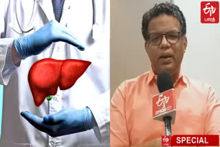 World Liver Day 2023 Tips from doctors for a healthy liver