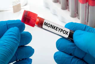 New Rapid Test For Mpox