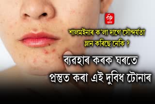 Dark spots started appearing on the face due to acne These toners will remove scars