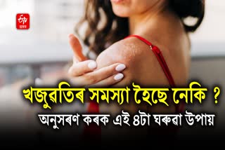 Itching due to hot sun and sweating? Try 4 home remedies, you will get instant relief from skin rash