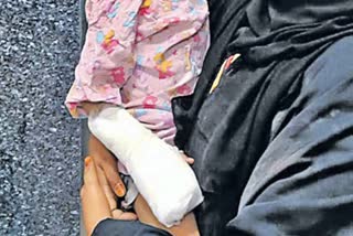 Girl four fingers were severed  she put her hand in a machine  play zone in the city mall center in Hyderabad  ಪ್ಲೇ ಝೋನ್​ನಲ್ಲಿ ಆಟ  ಆಟವಾಡಲು ಹೋಗಿ ನಾಲ್ಕು ಬೆರಳು ಕಳೆದುಕೊಂಡ 3 ವರ್ಷದ ಮಗು  ತೆಲಂಗಾಣದ ಹೈದರಾಬಾದ್‌ನಲ್ಲಿ ದುರಂತ ಘಟನೆ  ಸಿಟಿ ಮಾಲ್ ಸೆಂಟರ್‌ನಲ್ಲಿರುವ ಪ್ಲೇ ಝೋನ್‌  ಸ್ಮ್ಯಾಶ್ ಬೌಲಿಂಗ್ ಗೇಮಿಂಗ್ ಪ್ಲೇ ಝೋನ್‌  ಮಕ್ಸೂದ್ ಮತ್ತು ಜಹಾನ್ ಅವರ ಮೂರು ವರ್ಷದ ಮಗಳು ಮೆಹ್ವಿಶ್