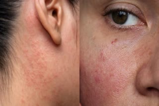 skin problems in women