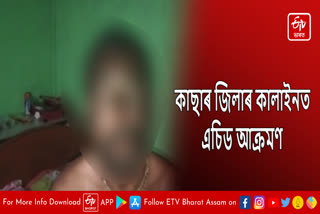 Acid attack at Kalain in Cachar