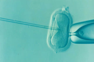 A baby is born through a new IVF process from the DNA of three people