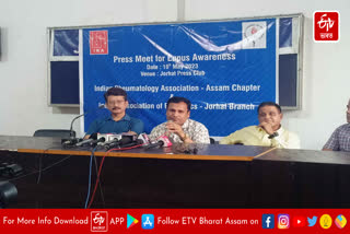 Press Meet for Lupas Awarness in Jorhat