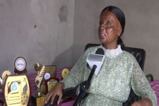 Acid attack survivor