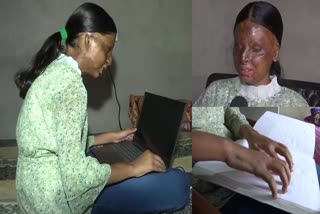 Acid Attack Survivor Khafi