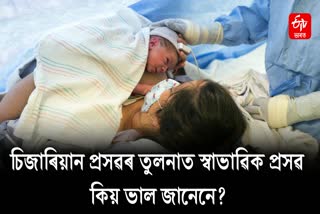 Do you know the Side Effects of Cesarean Delivery
