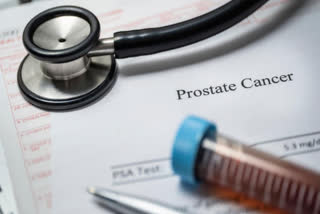 Risk of prostate cancer with weight gain