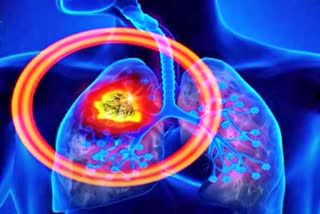 Air pollution Lung disease relation