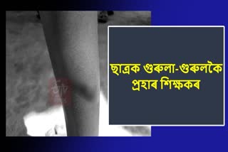 Student beaten by teacher at Merapani