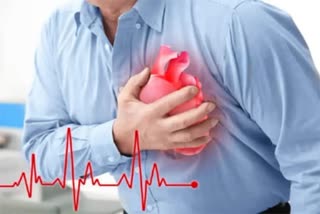 heart disease  acute cardiac events deaths  Delay in seeking treatment  Delay in seeking treatment caused to death  health news  stroke  മരണ സംഖ്യ  ഹൃദയാഘാതം  ചികിത്സ തേടുന്നതിലെ കാലതാമസം  ഹൃദയ സംബന്ധമായ അസുഖങ്ങൾ  ആരോഗ്യ വാർത്തകൾ