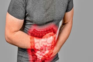 inflammatory bowel disease