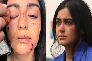 The Kerala Story heroine Adah Sharma posts behind the scenes photos reveals that she dehydrated herself for 40 hours while filming