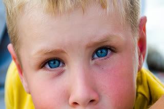 Eye drops slow nearsightedness progression in children: Research