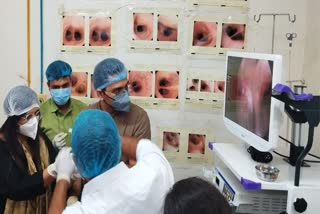 installation-of-bronchoscopy-machine-in-respiratory-medicine-department-of-surat-navi-civil-hospital